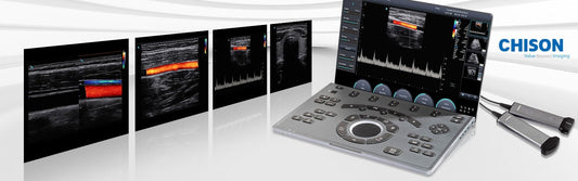 Chison SonoAir 70 Ultrasound System