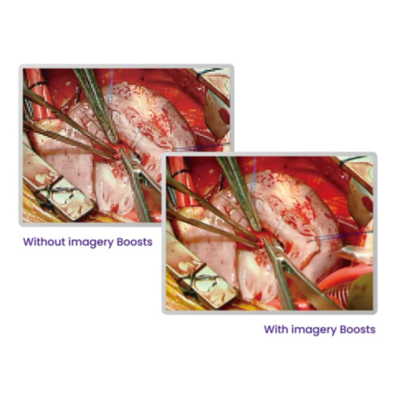 BenQ 27" 4K UHD Surgical Display
