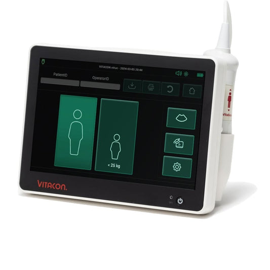 Vitascan eVue Bladder Scanner