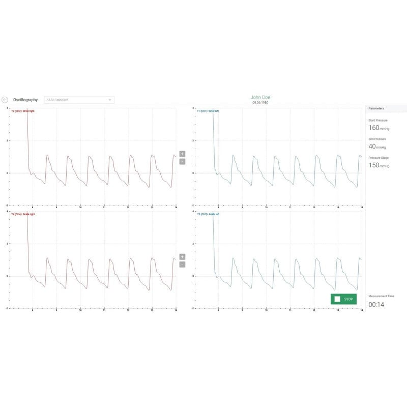 AngE™ ABI+ without TBI Add-On