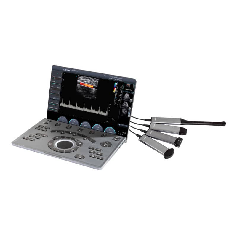 CHISON SonoAir 30 without trolley