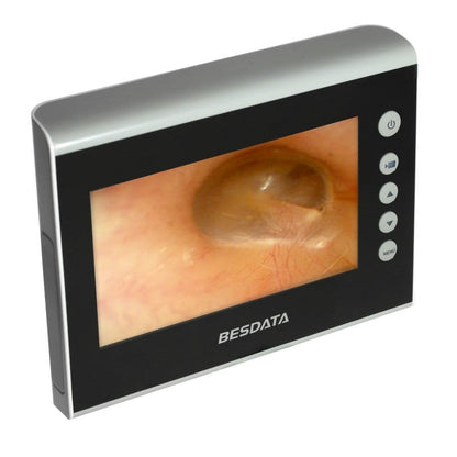 Bronchoscopy Monitor