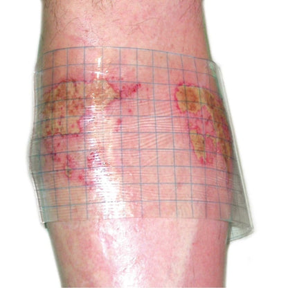 HydroTac transparent Gel Dressing 5 cm x 7.5 cm