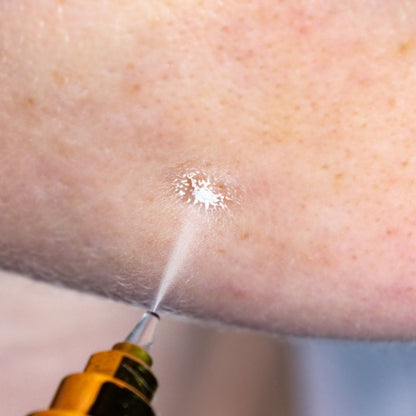 Cryoalfa SUPER Liquid | in blister
