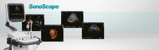 SonoScape S11 Plus ultrasound system battery included
