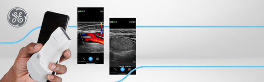 Vscan Air™ CL Ultrasound System