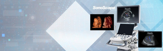 Sonoscape P15 Ultrasound Machine with battery