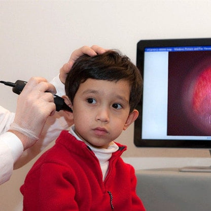 Firefly Video Otoscope DE500 (cable transfer)